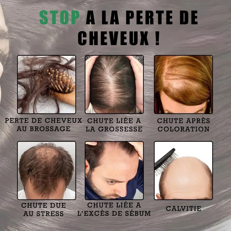 Élixir Concentré de Romarin pour Cheveux – Image 5