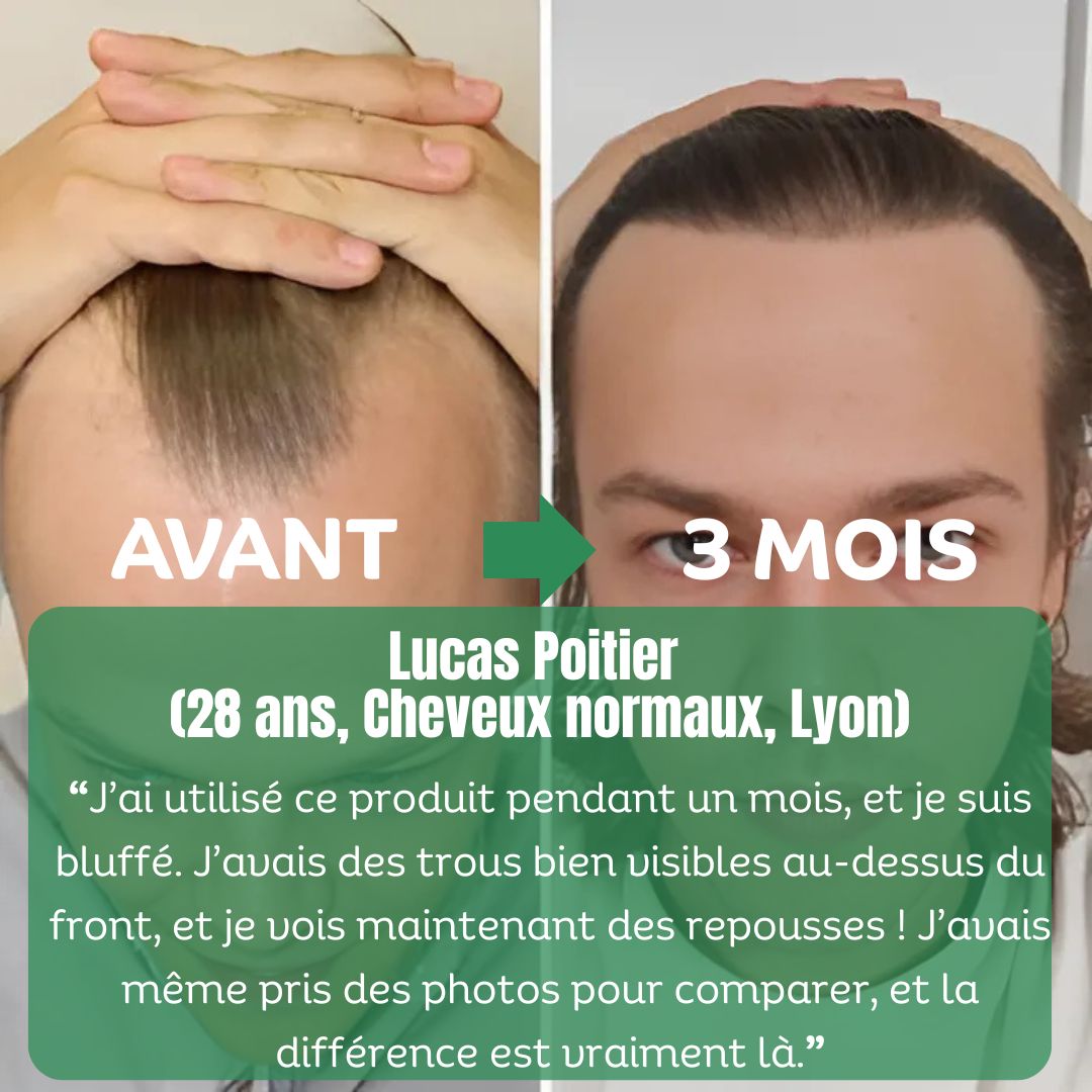 Sérum de Croissance Naturel au Romarin + Kit Bien-Être Offert – Image 5