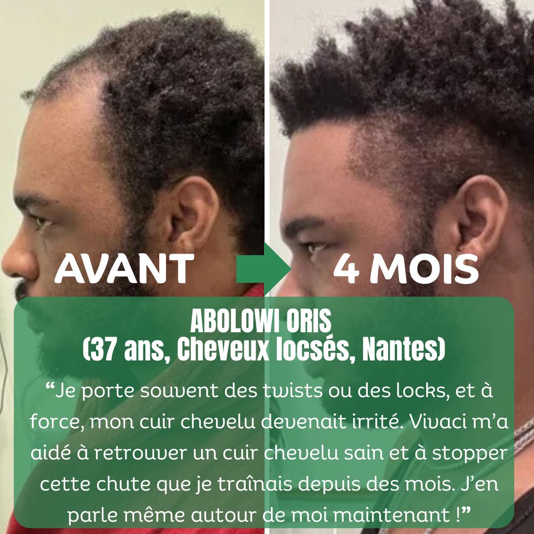 Shampoing & Après-Shampoing Fortifiants au Romarin Vivaci – Image 3