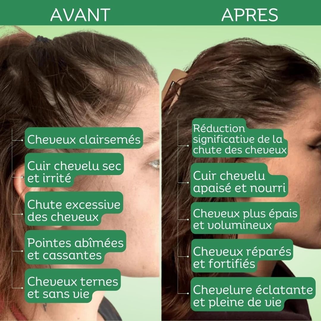 Spray Apaisant au Romarin Vivaci – Image 4