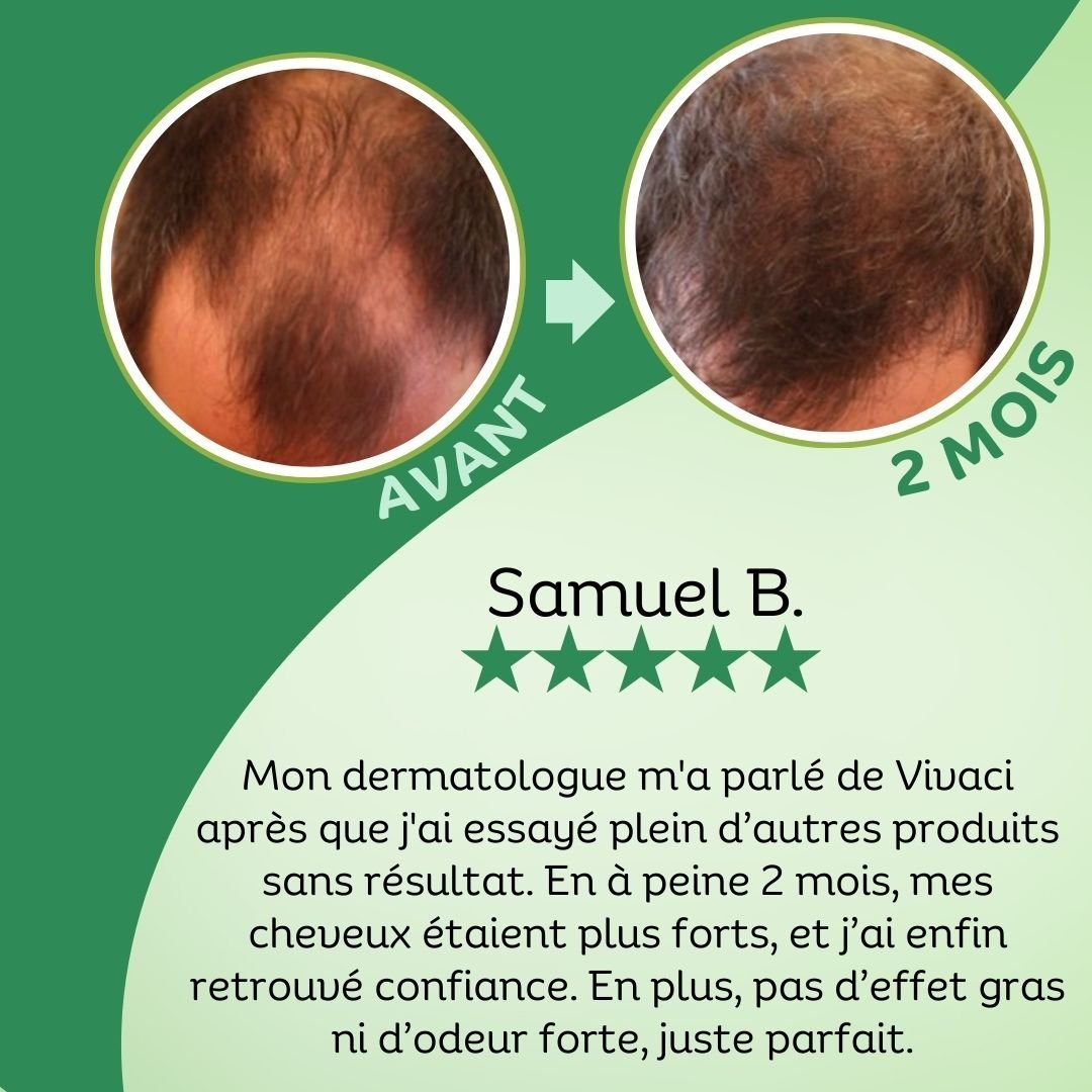 Gommage Purifiant au Romarin Vivaci – Image 5