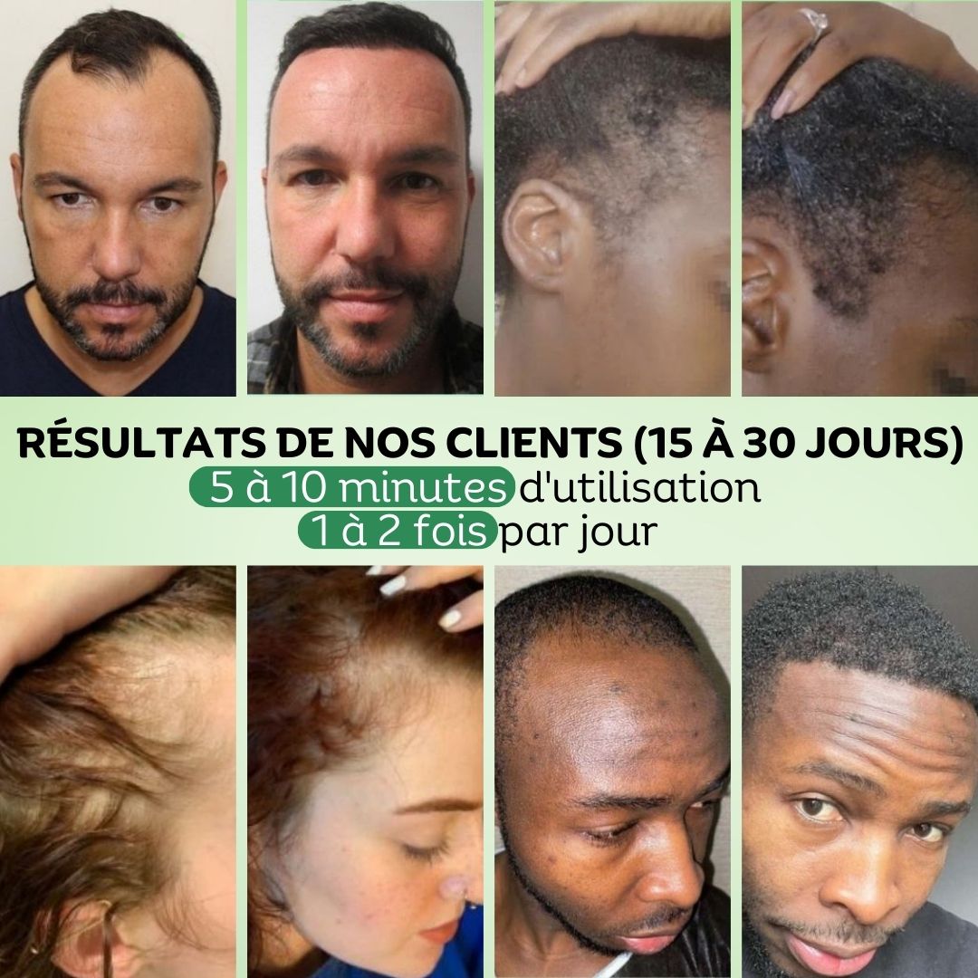 Gommage Purifiant au Romarin Vivaci – Image 2