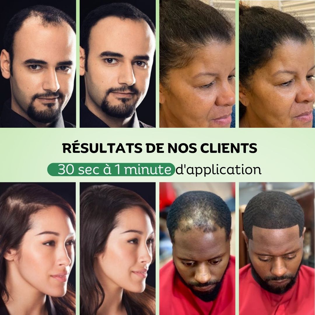 Le Pack Repousse & Densité Totale – Image 2