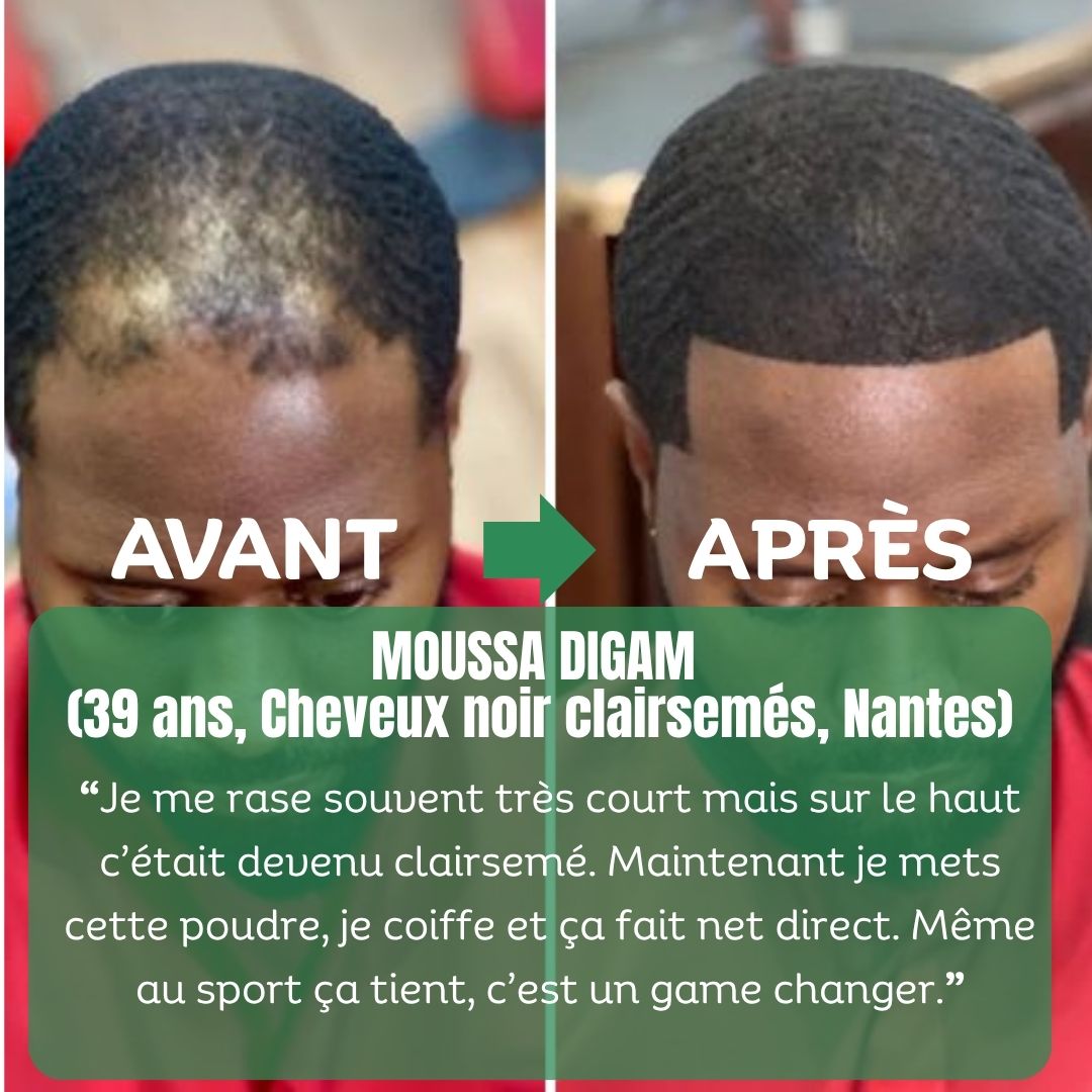 Pack Densité Ultime – Image 5